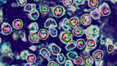 It’s not yet known how many people have gotten sick